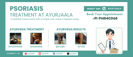 Psoriasis Management: Ayurvedic Approach & Finding Relief