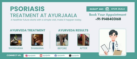 Psoriasis Management: Ayurvedic Approach & Finding Relief