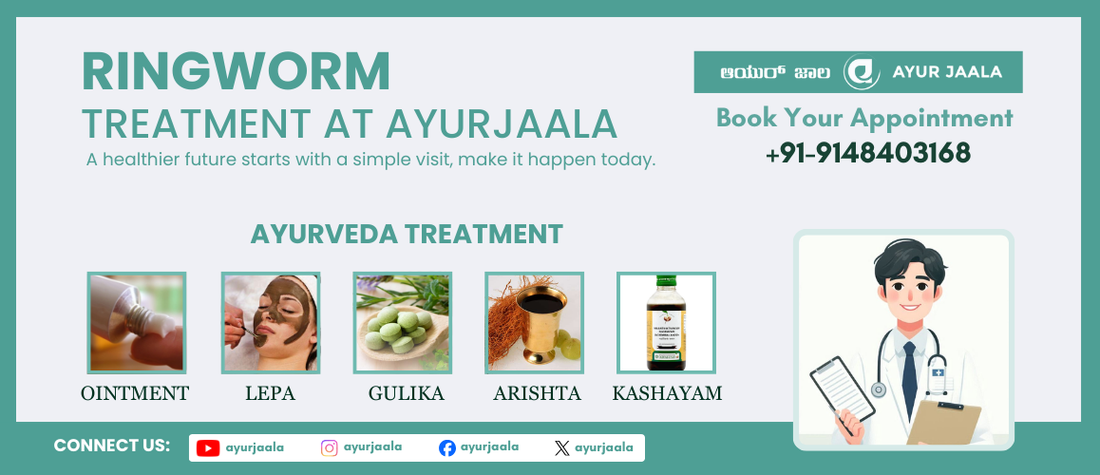 Ringworm Relief: Effective Ayurvedic Remedies for Tinea