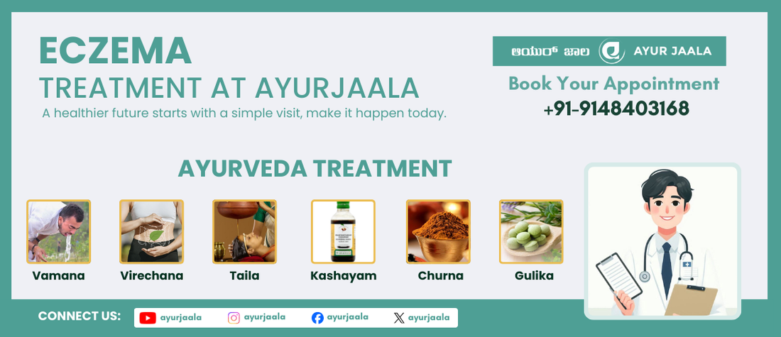 Eczema : Ayurvedic Approach to Soothing the Itch