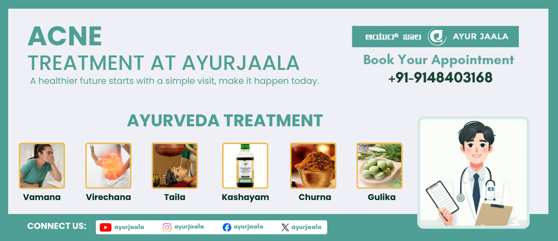 Fight Pimples Naturally: Unlocking the Power of Ayurveda for Acne-Free Skin